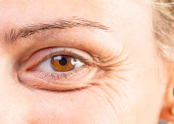 Si mund t’i largoni rrudhat e syve me metoda natyrale?!