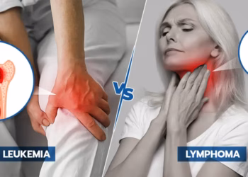 Leukemia dhe limfoma: Si dallojnë, simptomat dhe faktorët kryesorë të rrezikut