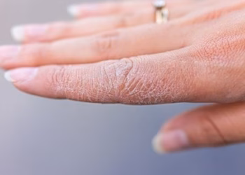 Për duart e thata ky veprim pas larjes ju ndihmon t’i keni gjithmonë të buta