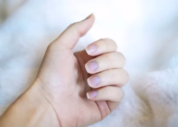 Ngjyra e thonjve mund të tregojë mungesë oksigjeni dhe probleme serioze shëndetësore