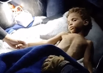 Një fëmijë nxirret i gjallë nga rrënojat në Venezuelë pas gjashtë ditësh