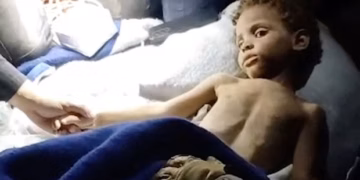 Një fëmijë nxirret i gjallë nga rrënojat në Venezuelë pas gjashtë ditësh