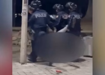 Përplasja me policinë në protestën e dhunshme, të riut i thyhet këmba