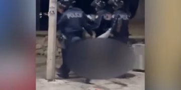 Përplasja me policinë në protestën e dhunshme, të riut i thyhet këmba